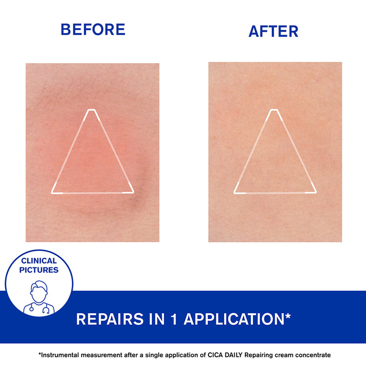 Uriage Bariederm Cica Daily Gel Cream 40ml