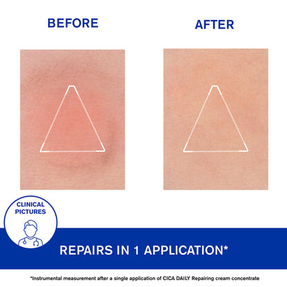 Uriage Bariederm Cica Daily Gel Cream 40ml