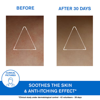 (Medical) Uriage Xemose Lipid-Replenishing Anti-Irritation Cerat 200ml