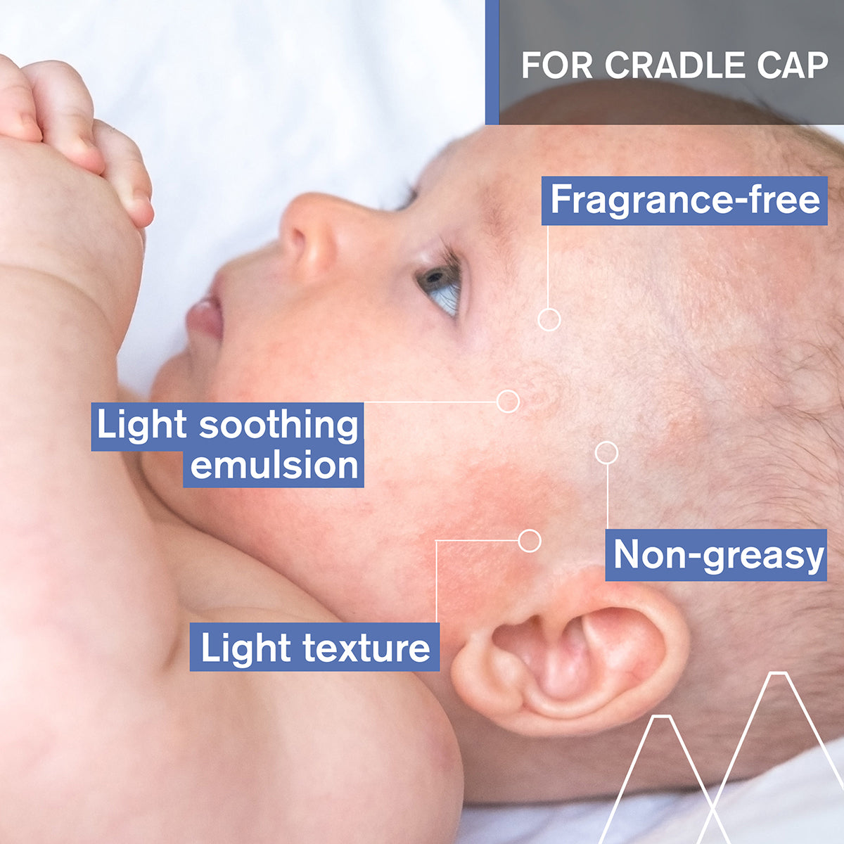 (Medical) Uriage Baby's 1st Cradle Cap Care Cream 40ml