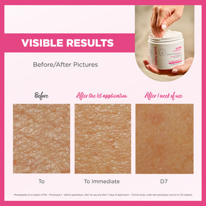 Topicrem Ultra-Moisturizing Comforting Body Balm 380ml