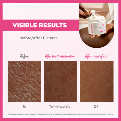 Topicrem Ultra-Moisturizing Comforting Body Balm 380ml