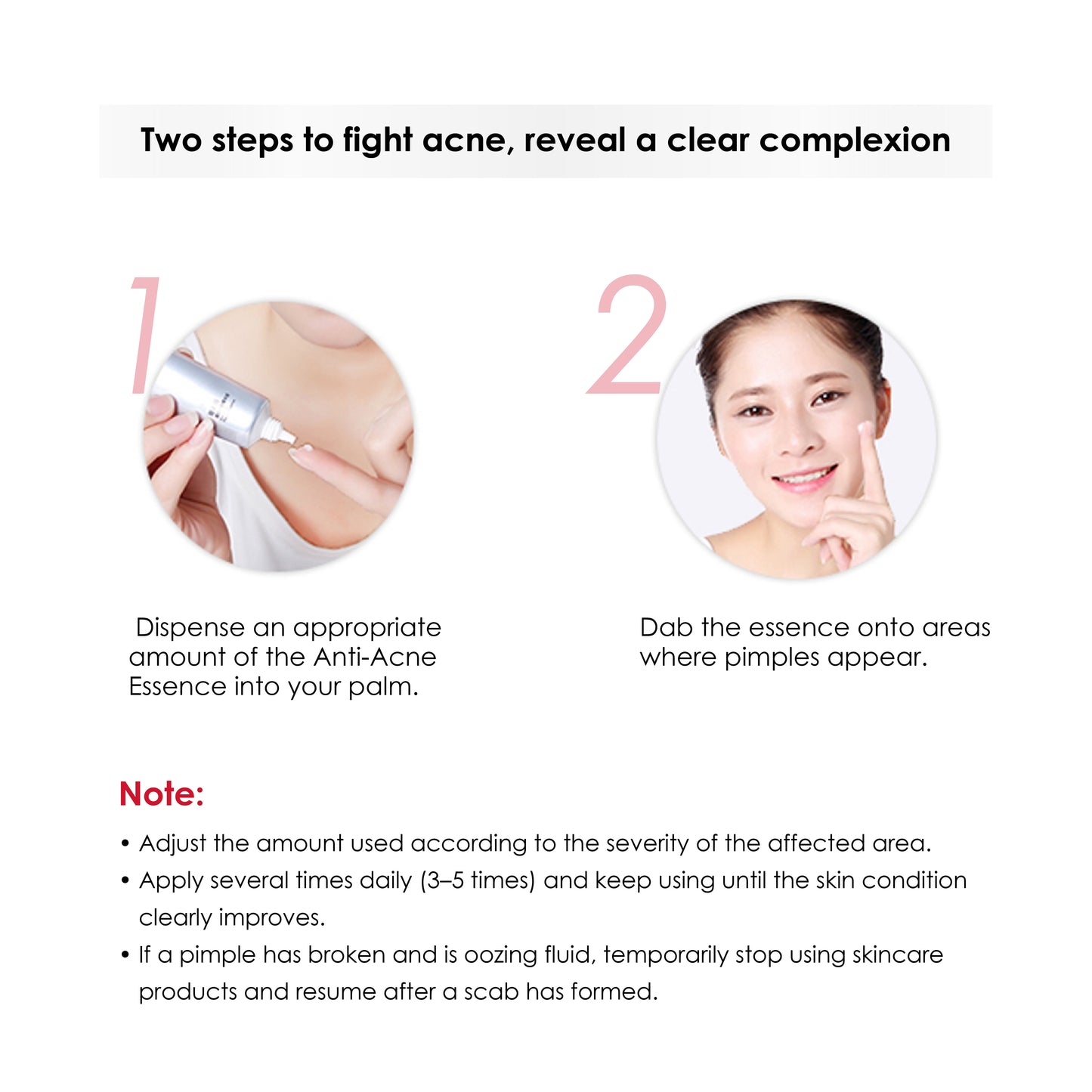 Winona Anti-Acne Essence 12g