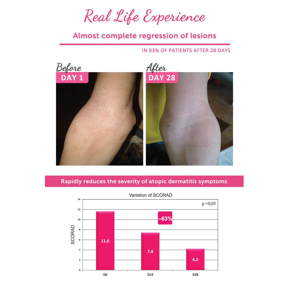 Topicrem DA Emollient Balm (75ml/200ml)