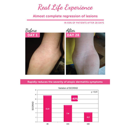 Topicrem DA Emollient Balm (75ml/200ml)